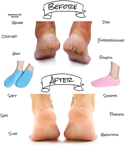 Moisturizing Spa Gel Socks ( Hot Selling )